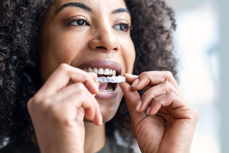 Clear Aligner Therapy in Hamilton & Stevensville, MT