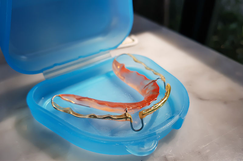Retainers in Hamilton & Stevensville, MT