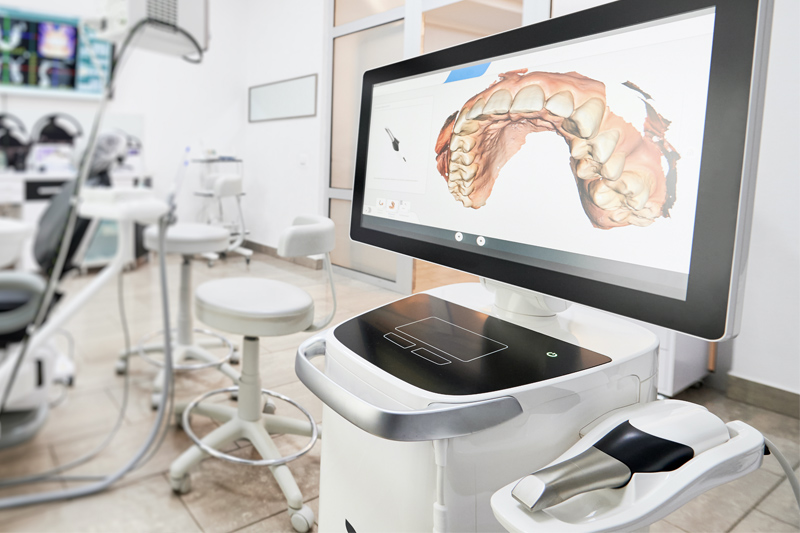 iTero Intra-Oral Scanner in Hamilton & Stevensville, MT