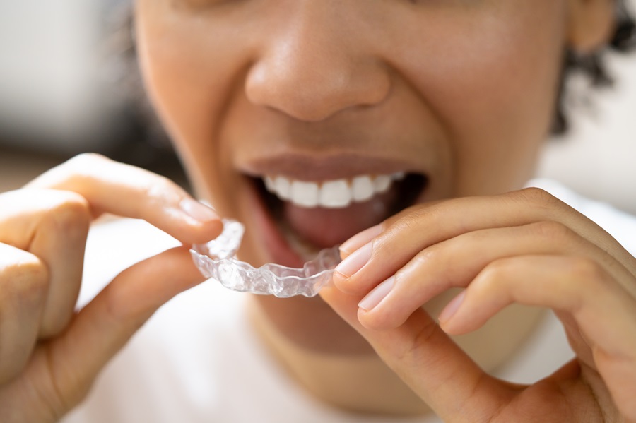 Aligning Your Journey to a Confident Smile: The Power of Clear Aligners
