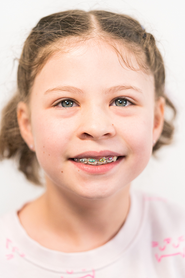 Signs Your Child May Need Early Orthodontic Treatment: What to Look For