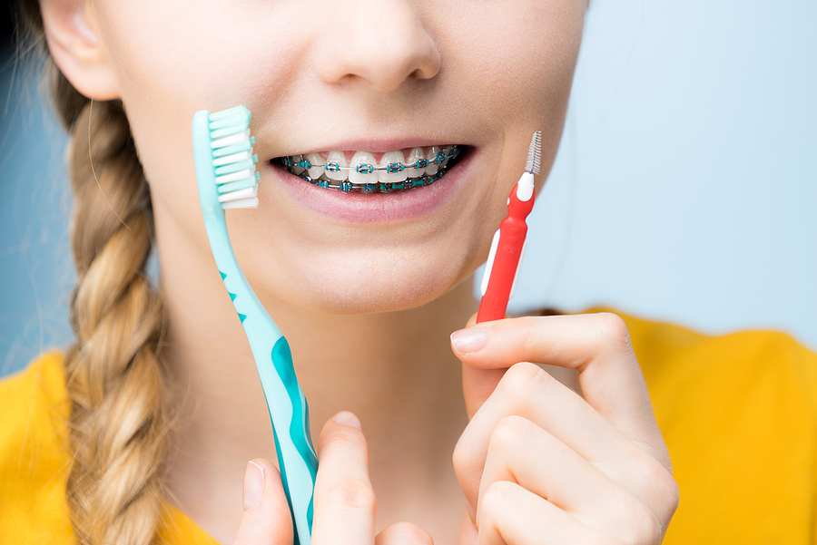 Common Orthodontic Emergencies and How to Handle Them